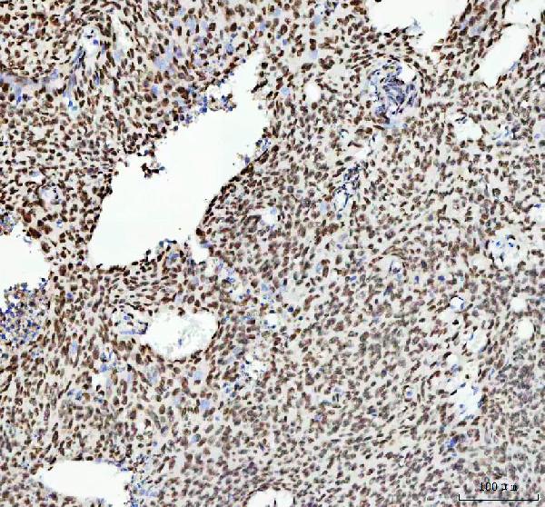 2 - Anti-TAF15 Rabbit Monoclonal Antibody ABO16196