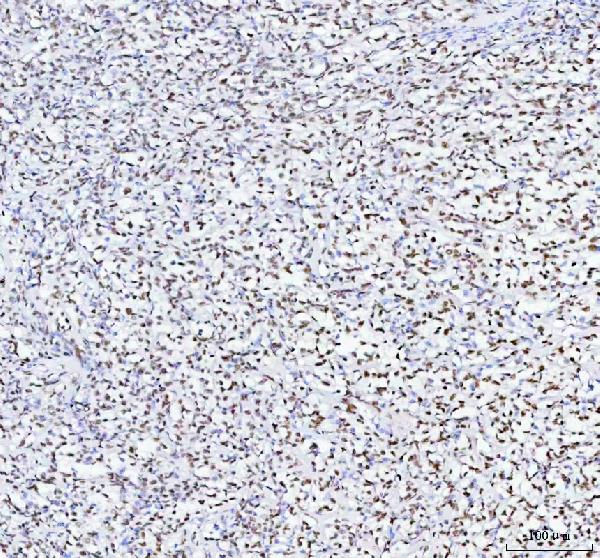 2 - Anti-TAF15 Rabbit Monoclonal Antibody ABO16196