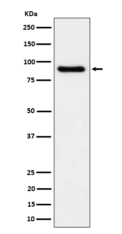 1 - Anti-C1s Rabbit Monoclonal Antibody ABO16197