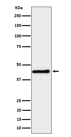 1 - Anti-DPF2 Rabbit Monoclonal Antibody ABO16198