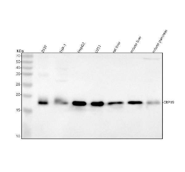 1 - Anti-ERp19 Rabbit Monoclonal Antibody ABO16199