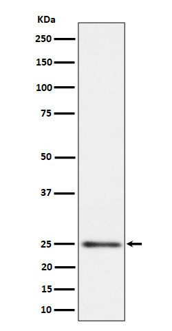 1 - Anti-MRPS15 Rabbit Monoclonal Antibody ABO16201