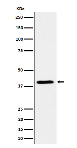 1 - Anti-ADH4 Rabbit Monoclonal Antibody ABO16204