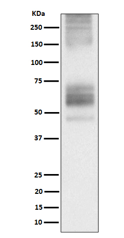 1 - Anti-Somatostatin Receptor 1 Rabbit Monoclonal Antibody ABO16207