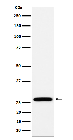 1 - Anti-RPL13 Rabbit Monoclonal Antibody ABO16209
