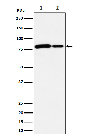 1 - Anti-MMUT Rabbit Monoclonal Antibody ABO16211
