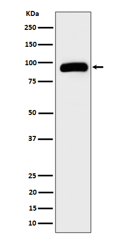 1 - Anti-TRPV5 Rabbit Monoclonal Antibody ABO16212