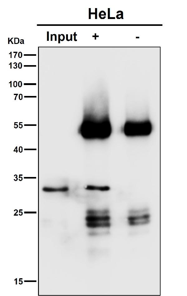 1 - Anti-SNAP29 Rabbit Monoclonal Antibody ABO16213