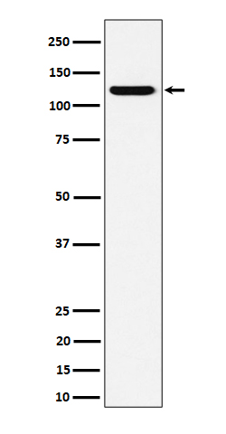1 - Anti-PKN2 Rabbit Monoclonal Antibody ABO16214