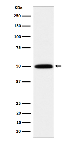 1 - Anti-HARS Rabbit Monoclonal Antibody ABO16216