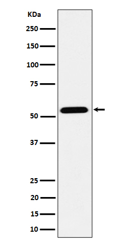 1 - Anti-ENPP5 Rabbit Monoclonal Antibody ABO16218