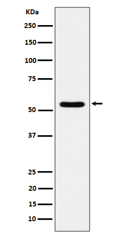 1 - Anti-TOE1 Rabbit Monoclonal Antibody ABO16220