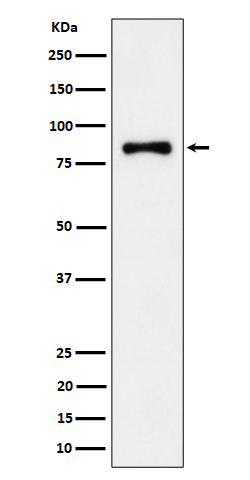 1 - Anti-ALDH16A1 Rabbit Monoclonal Antibody ABO16221