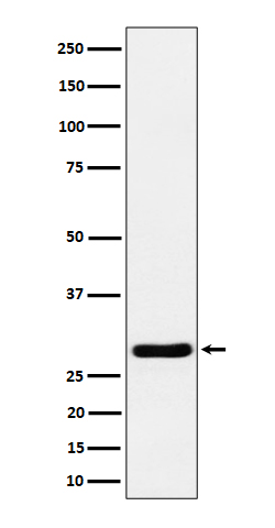 1 - Anti-Calcipressin 1 Rabbit Monoclonal Antibody ABO16223