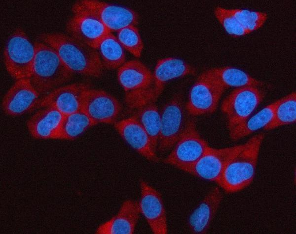 3 - Anti-Sterol carrier protein 2 Rabbit Monoclonal Antibody ABO16226