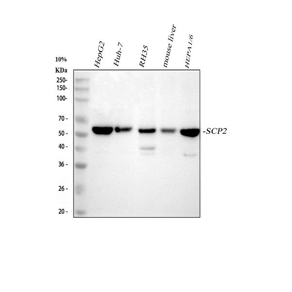 1 - Anti-Sterol carrier protein 2 Rabbit Monoclonal Antibody ABO16226