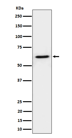 1 - Anti-IKZF3 Rabbit Monoclonal Antibody ABO16227