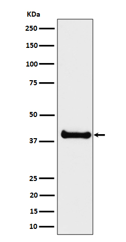 1 - Anti-ALS2CR1 Rabbit Monoclonal Antibody ABO16229