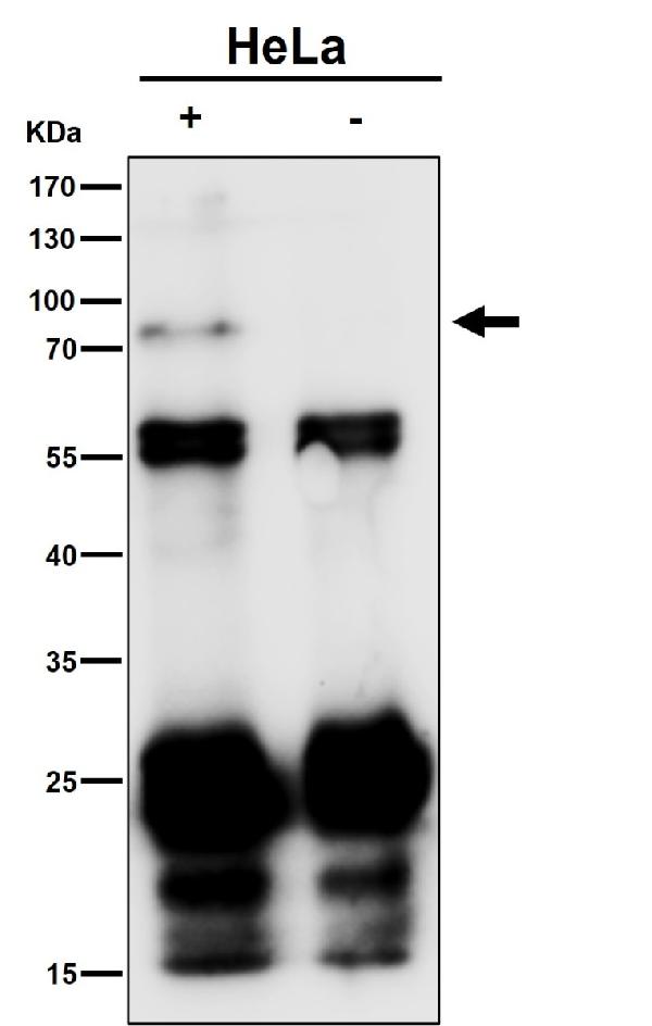 1 - Anti-Phospho-TAK1 (S439) Rabbit Monoclonal Antibody ABO16230