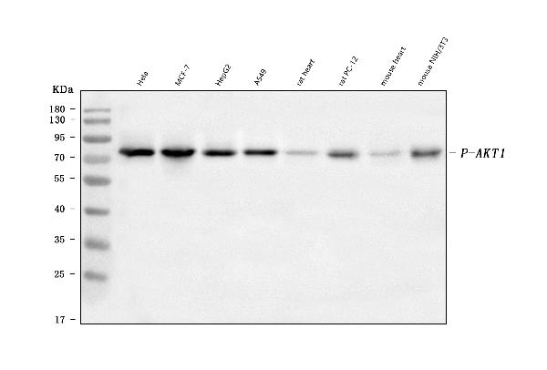 1 - Anti-Phospho-TAK1 (S439) Rabbit Monoclonal Antibody ABO16230
