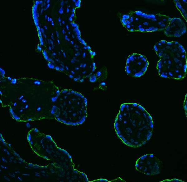 3 - Anti-ALPP Antibody Picoband™ (monoclonal, 6C7G3) ABO16233