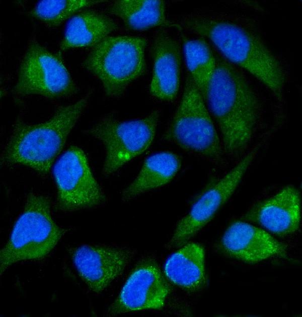 3 - Anti-ALPP Antibody Picoband™ (monoclonal, 6C7G3) ABO16233