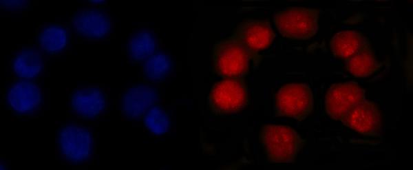 3 - Anti-MSH2 Antibody Picoband™ (monoclonal, 6B4F7) ABO16234
