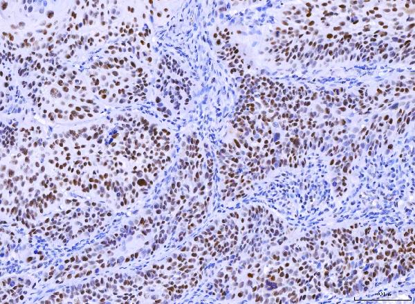 2 - Anti-MSH2 Antibody Picoband™ (monoclonal, 6B4F7) ABO16234