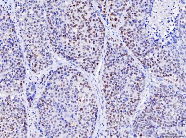 2 - Anti-MSH2 Antibody Picoband™ (monoclonal, 6B4F7) ABO16234