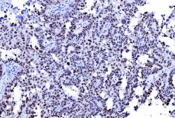 2 - Anti-MSH2 Antibody Picoband™ (monoclonal, 6B4F7) ABO16234