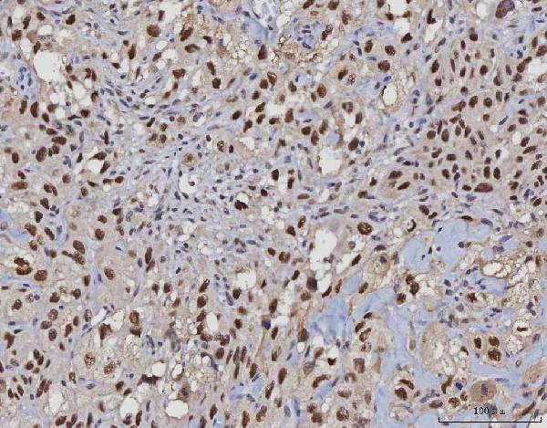 2 - Anti-MSH2 Antibody Picoband™ (monoclonal, 6B4F7) ABO16234