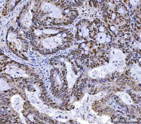 2 - Anti-MSH2 Antibody Picoband™ (monoclonal, 6B4F7) ABO16234