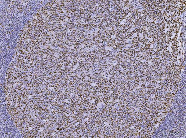 2 - Anti-MSH2 Antibody Picoband™ (monoclonal, 6B4F7) ABO16234