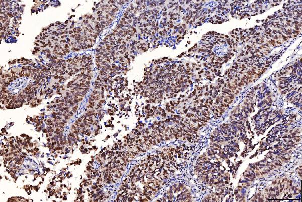 2 - Anti-FEN1 Antibody Picoband™ (monoclonal, 6F3F2) ABO16236