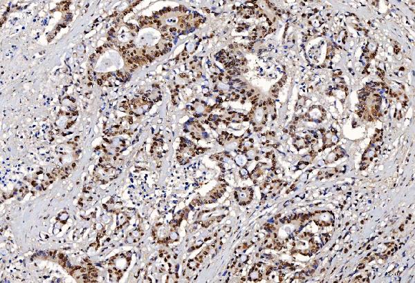 2 - Anti-FEN1 Antibody Picoband™ (monoclonal, 6F3F2) ABO16236