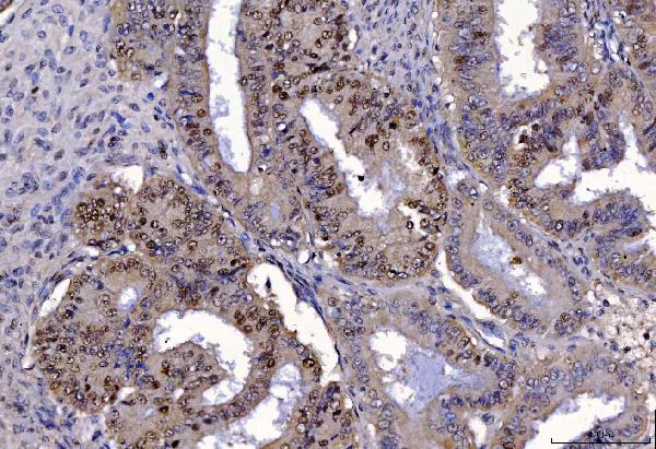2 - Anti-FEN1 Antibody Picoband™ (monoclonal, 6F3F2) ABO16236