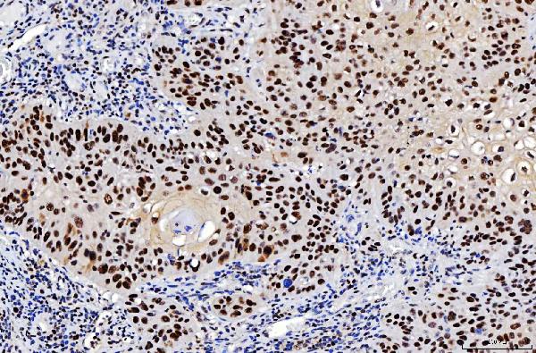2 - Anti-FEN1 Antibody Picoband™ (monoclonal, 6F3F2) ABO16236