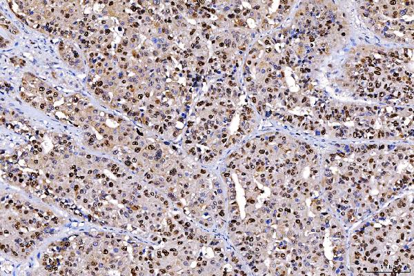 2 - Anti-FEN1 Antibody Picoband™ (monoclonal, 6F3F2) ABO16236
