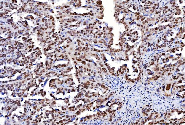 2 - Anti-FEN1 Antibody Picoband™ (monoclonal, 6F3F2) ABO16236