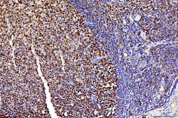 2 - Anti-FEN1 Antibody Picoband™ (monoclonal, 6F3F2) ABO16236