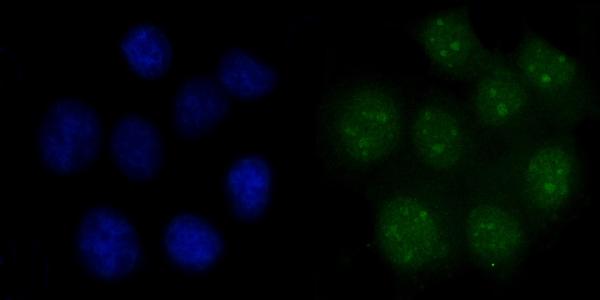 3 - Anti-FEN1 Antibody Picoband™ (monoclonal, 7D11D7) ABO16237