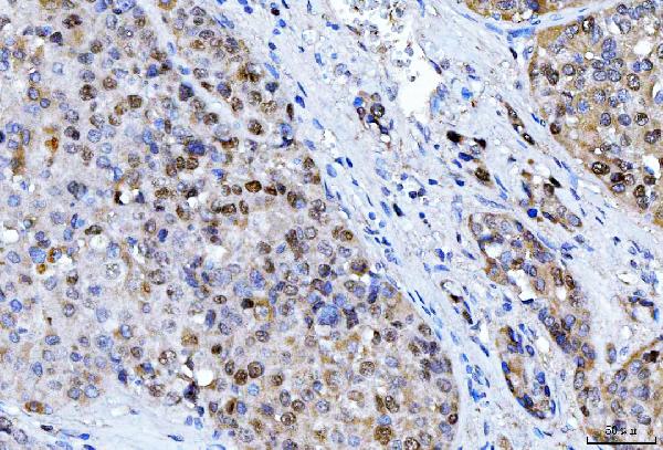 2 - Anti-FEN1 Antibody Picoband™ (monoclonal, 7D11D7) ABO16237