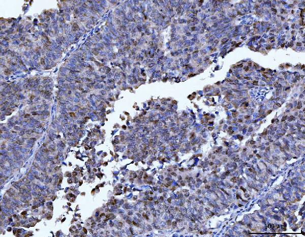 2 - Anti-FEN1 Antibody Picoband™ (monoclonal, 7D11D7) ABO16237