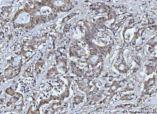 2 - Anti-FEN1 Antibody Picoband™ (monoclonal, 7D11D7) ABO16237