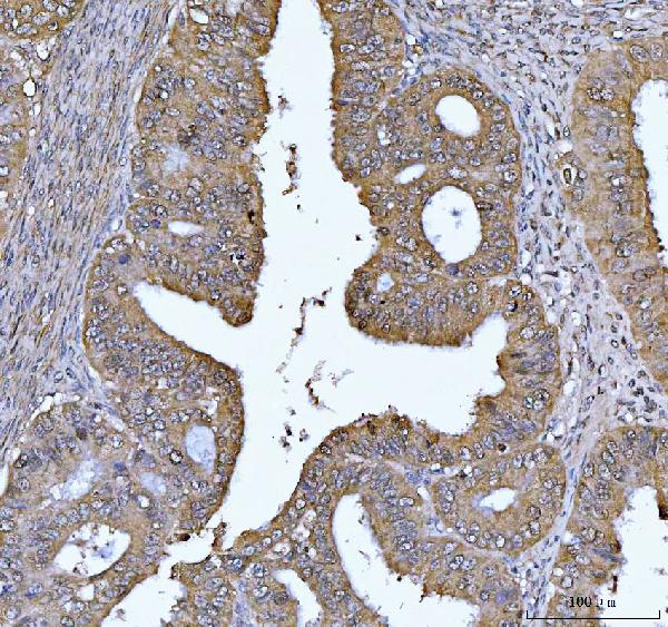 2 - Anti-FEN1 Antibody Picoband™ (monoclonal, 7D11D7) ABO16237