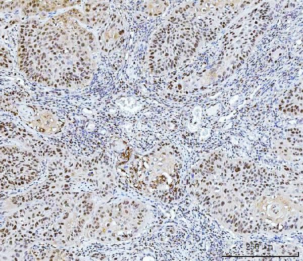 2 - Anti-FEN1 Antibody Picoband™ (monoclonal, 7D11D7) ABO16237