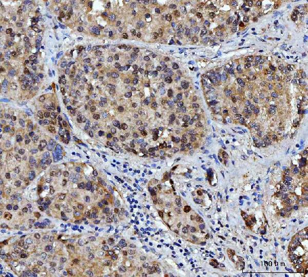 2 - Anti-FEN1 Antibody Picoband™ (monoclonal, 7D11D7) ABO16237