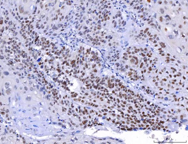 2 - Anti-YY1 Antibody Picoband™ (monoclonal, 6H3E1) ABO16238