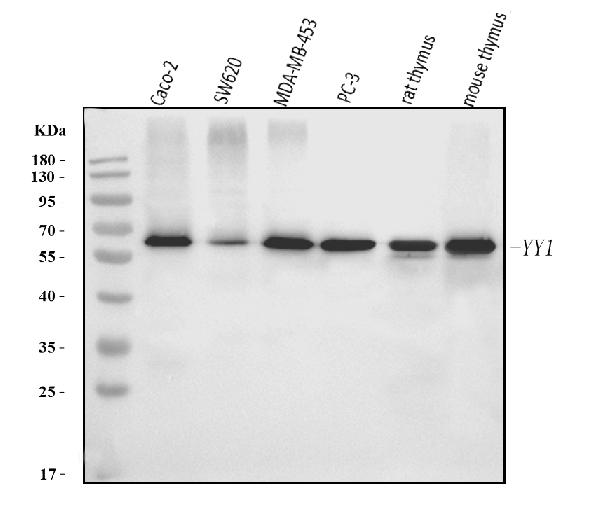 1 - Anti-YY1 Antibody Picoband™ (monoclonal, 6H3E1) ABO16238