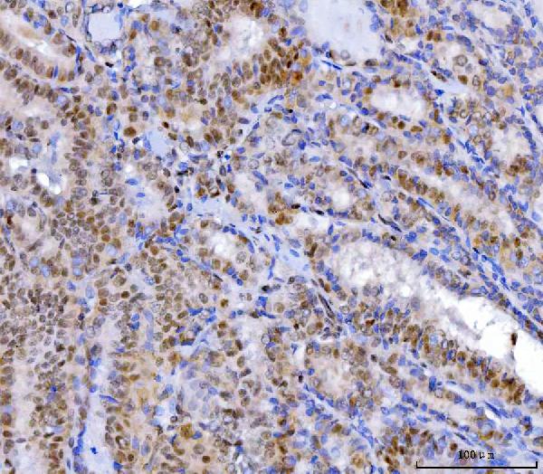 2 - Anti-YY1 Antibody Picoband™ (monoclonal, 2C10F9) ABO16239